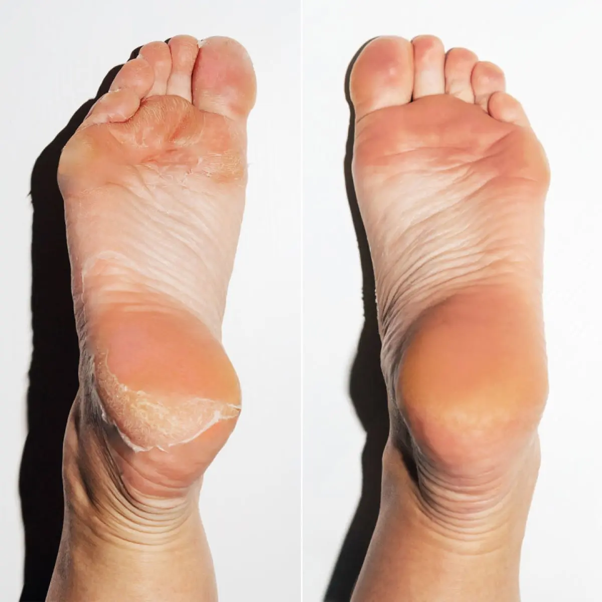 Dream Feet Mask - Image 3